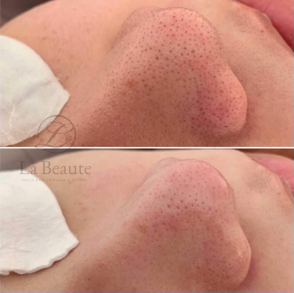 before・afterの写真１