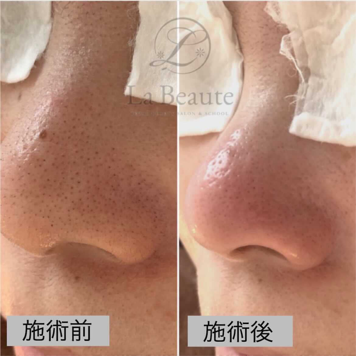 before・afterの写真２